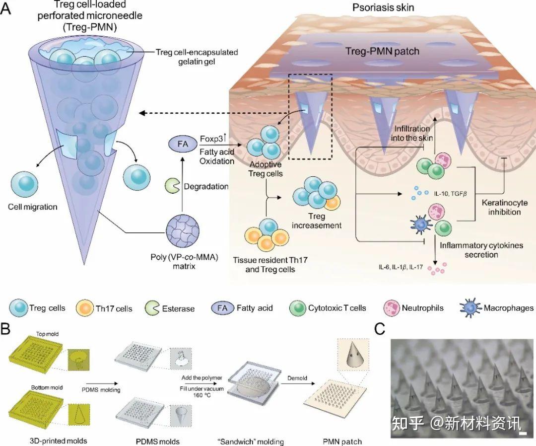 浙大顾臻/张宇琪团队：穿孔微针用于调节性T细胞局部缓控释 - 知乎
