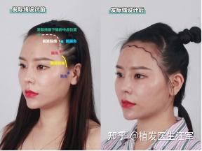 科普/女性发际线设计的美学标准 - 知乎