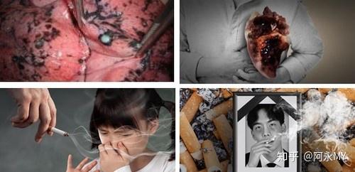 作者亚伦·卡尔,长达33年的烟龄,每天100支烟.