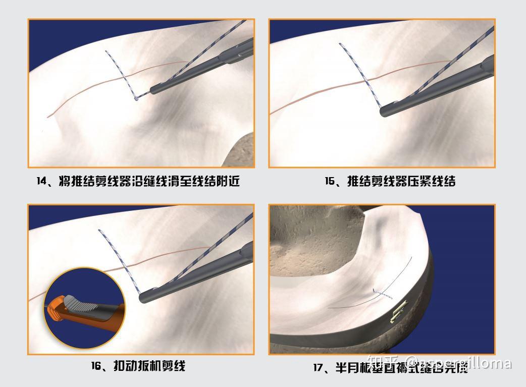 PDS是什么意思 百度知道