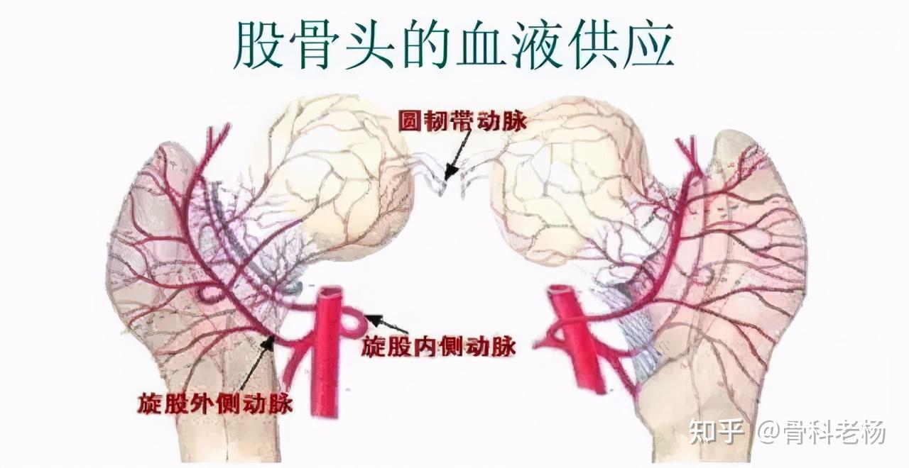 人體股骨頭處的血管較為細小,血管很容易遭到破壞或者堵塞,影響了股