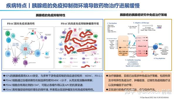 胰腺癌精准靶向治疗及免疫治疗进展 知乎