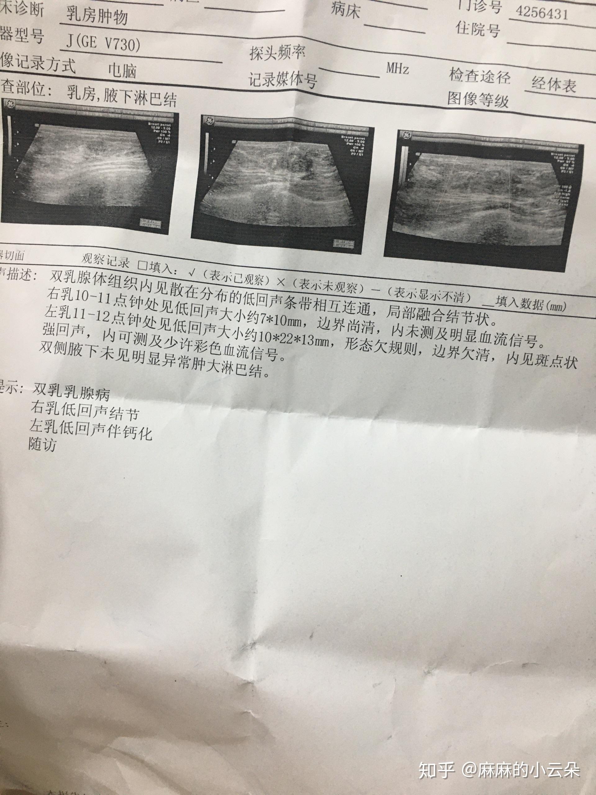 乳房有肿块偶尔痛严重吗要继续看医生吗