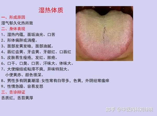 阴虚怕热、阳虚怕冷,8种体质对应8种舌象,看看你是属于哪一种? - 知乎