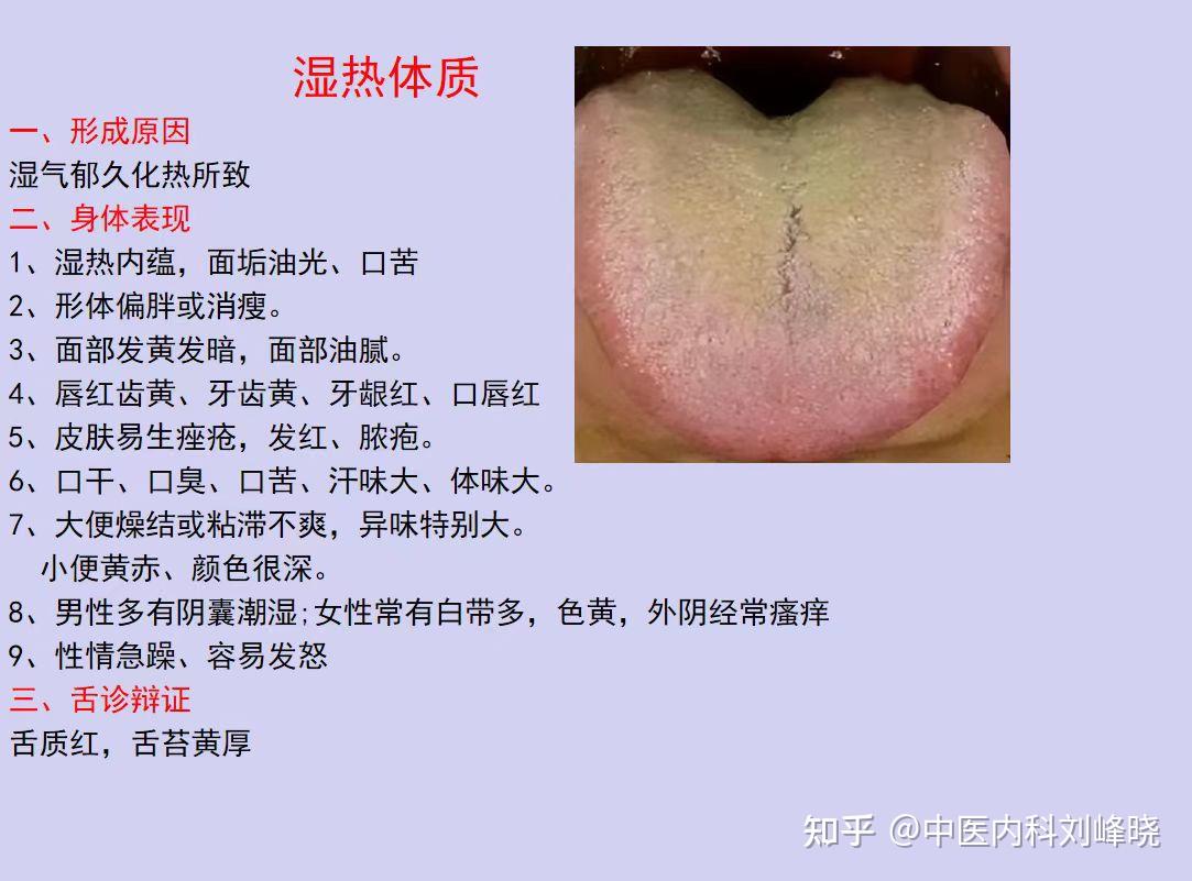 阴虚怕热、阳虚怕冷,8种体质对应8种舌象,看看你是属于哪一种? - 知乎