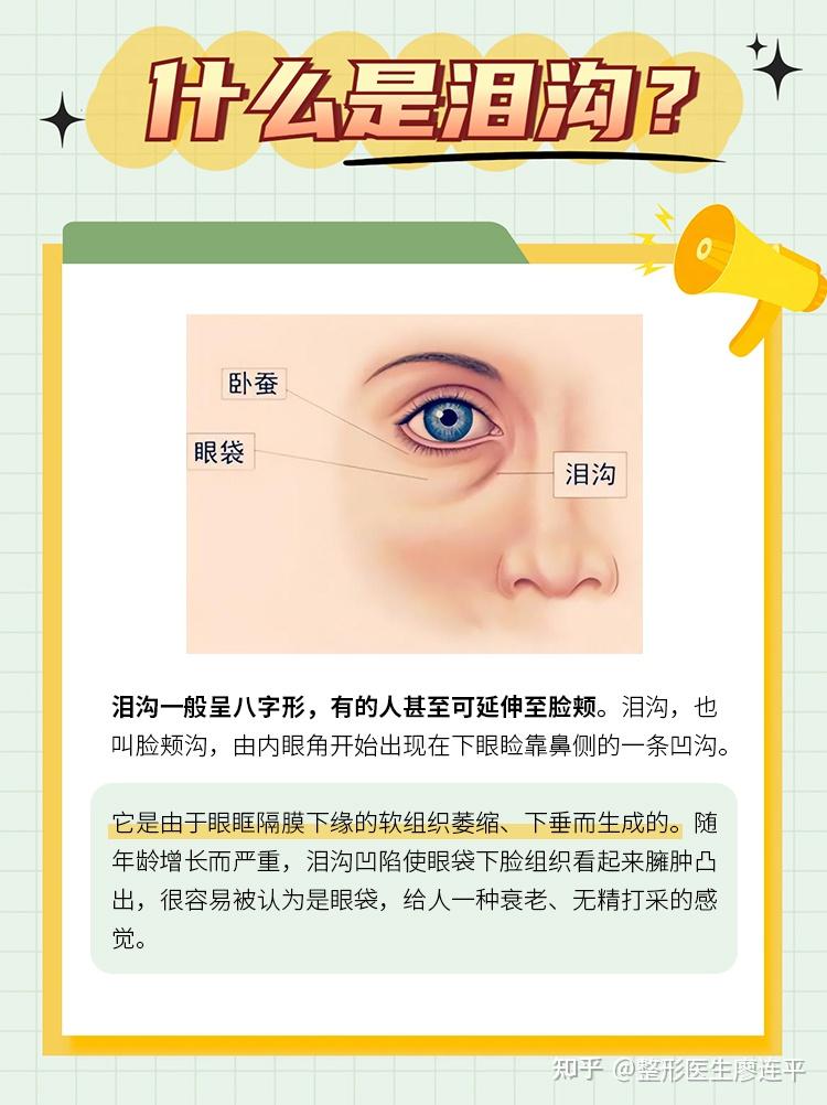 泪沟显老？必看的超全泪沟攻略来咯！ - 知乎