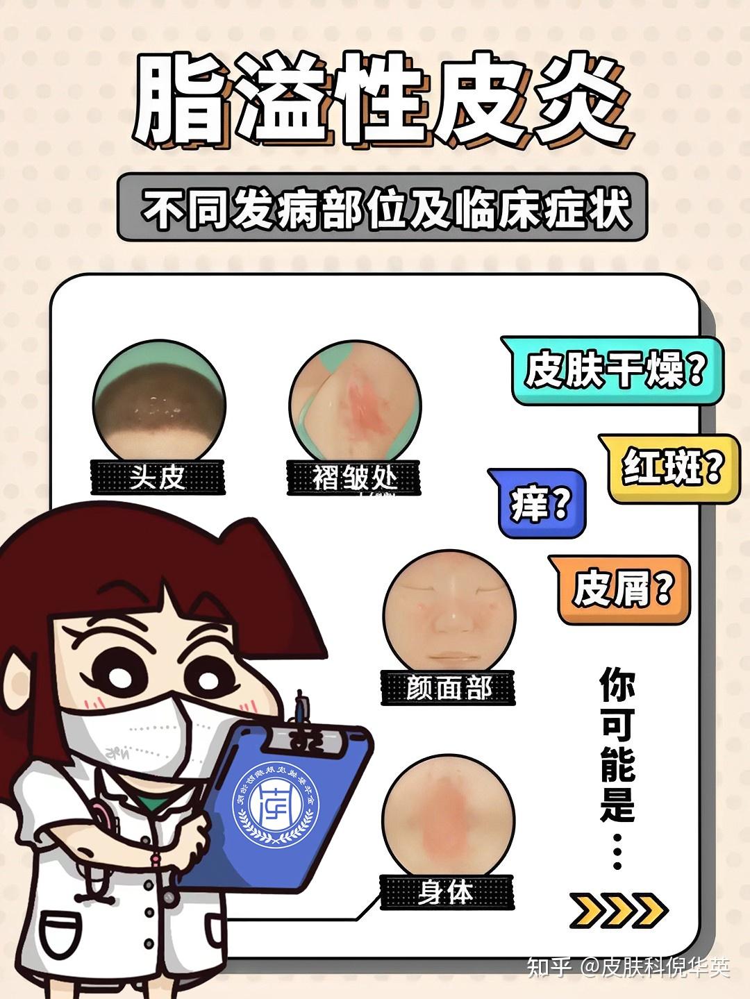 最容易忽视的脂溢性皮炎却是最难缠的 - 知乎