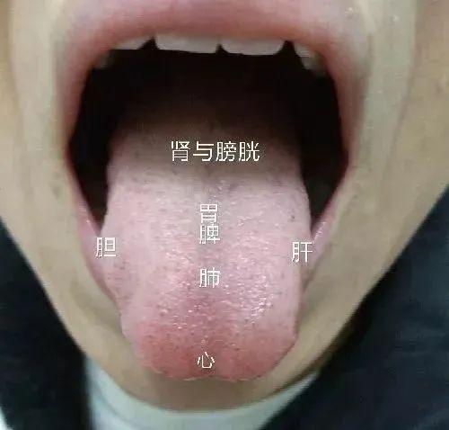 谁说老中医才会看舌诊,有了它,一秒就能出结果! - 知乎
