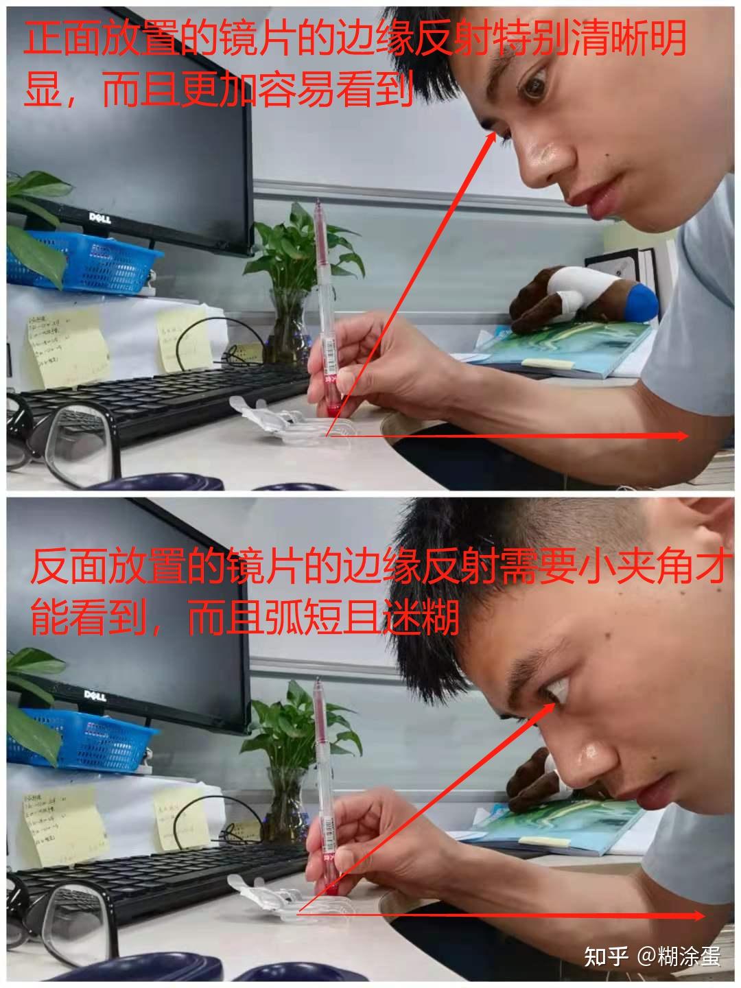 隐形眼镜正反面判断的一种新方法开盖零接触即可识别