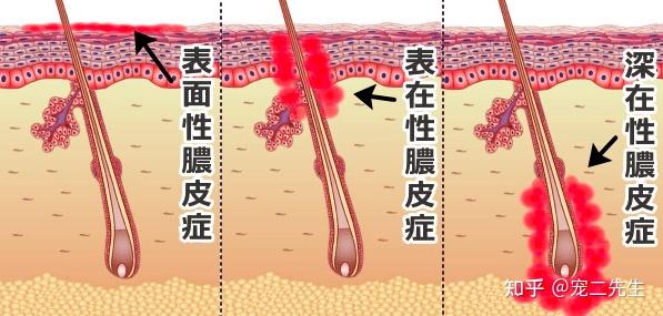 猫脓皮病的症状、原因和治疗方法 - 知乎