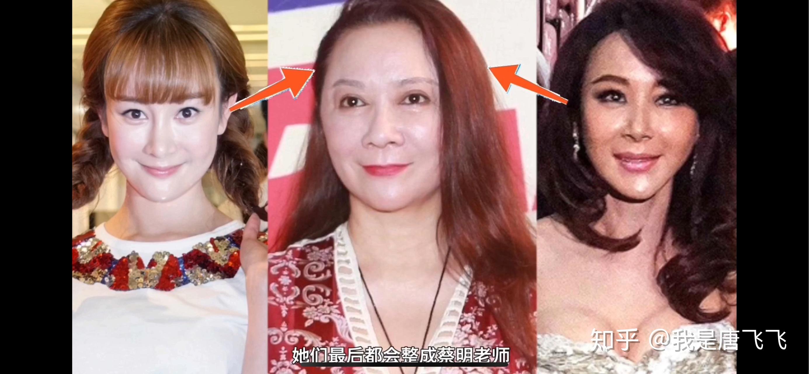 【颜值分析】为什么女明星的整容归宿都是蔡明？从整容角度讲原因【唐飞飞】 - 知乎