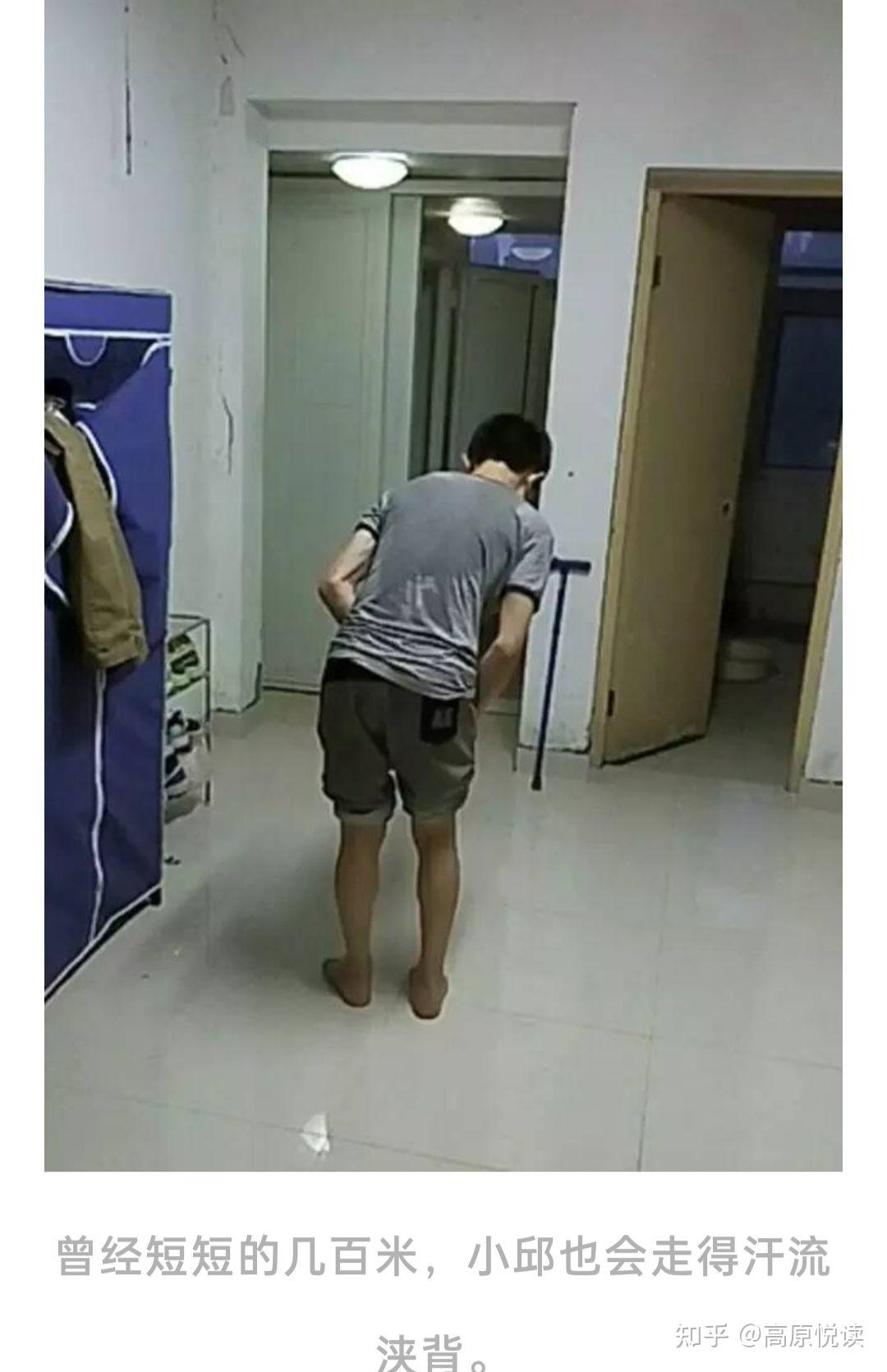 少年得怪病，扶墙走路6年，看完他的故事泪目了 - 知乎