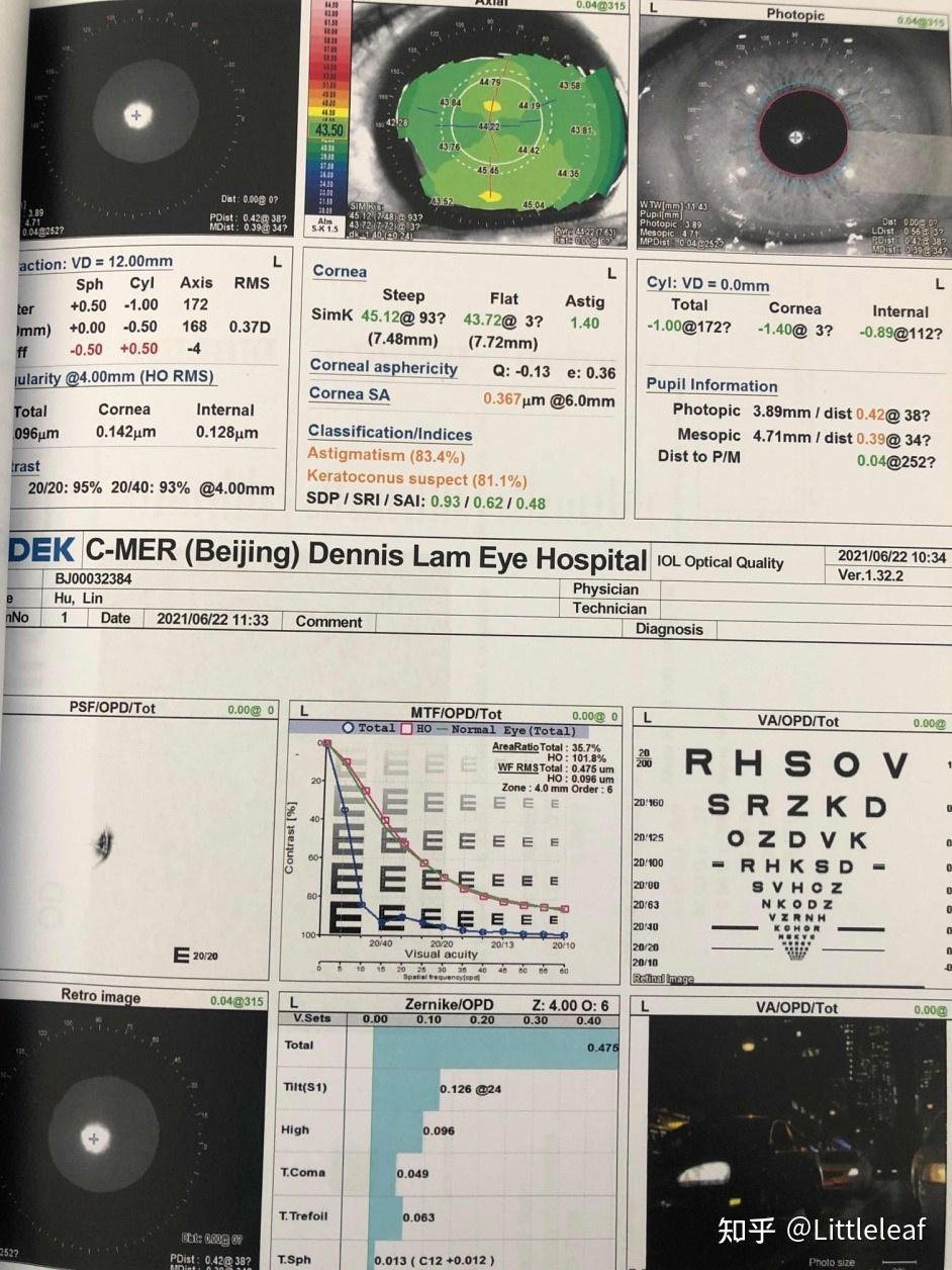 眼科OPD怎么读图希玛眼科医院再添“利器”助力屈光性白内障手术_https://www.jmylbn.com_新闻资讯_第6张
