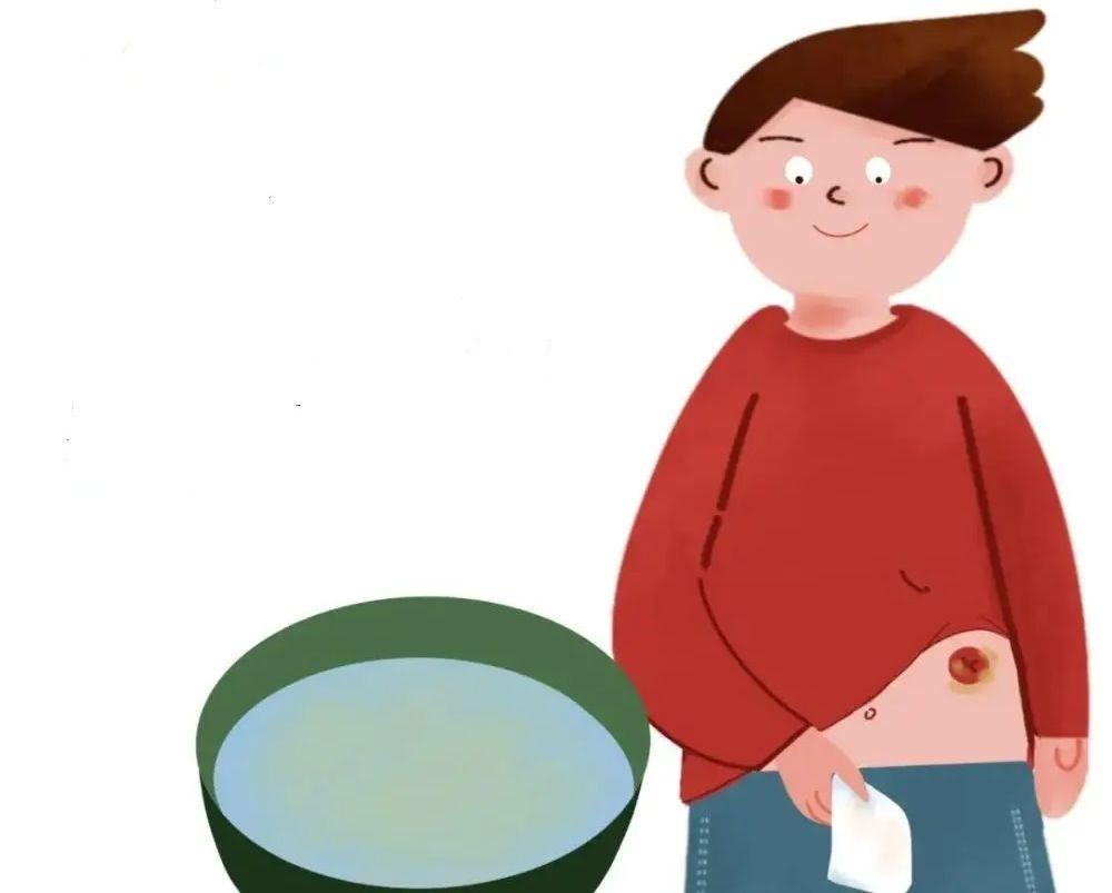 造口术后自身如何面对造口 - 知乎