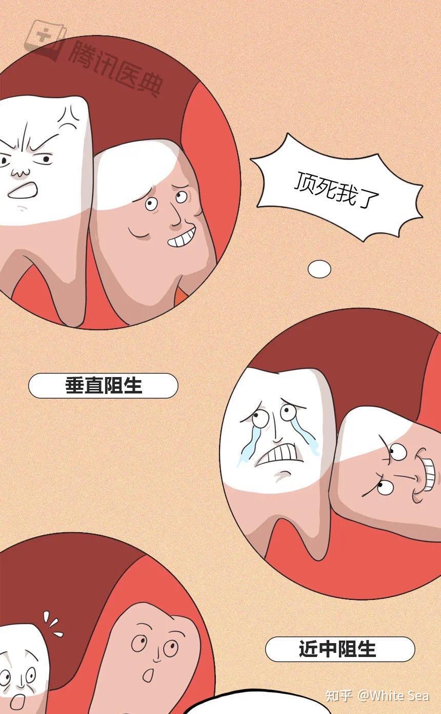 研究表明,只有30%的人不长智齿,而70%的人,都要与1-4颗智齿做斗争.