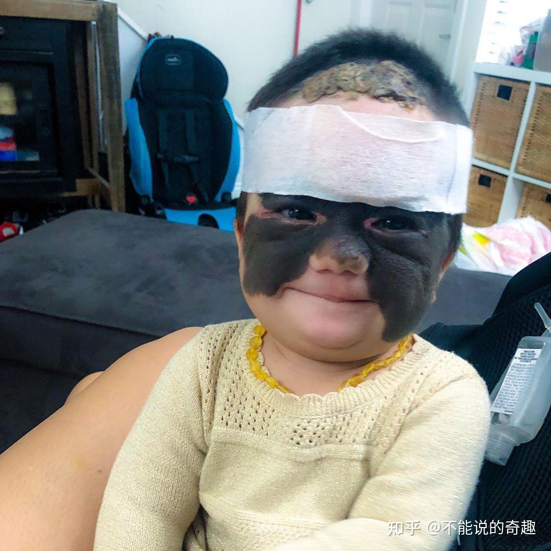 这婴儿真的很丑脸部80黑块的她刚出生就受到这些羞辱