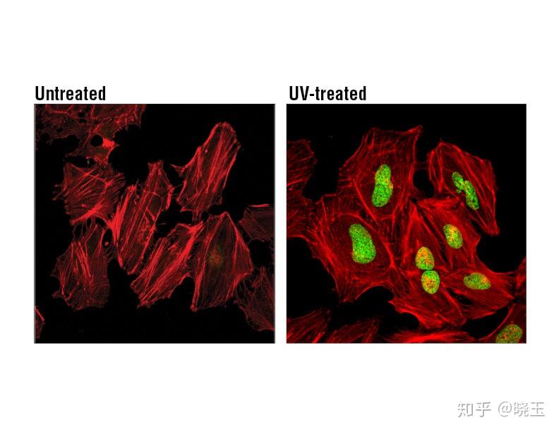 h2a.x 是一種常用的細胞衰老標誌物.使用 phospho-histone h2a.