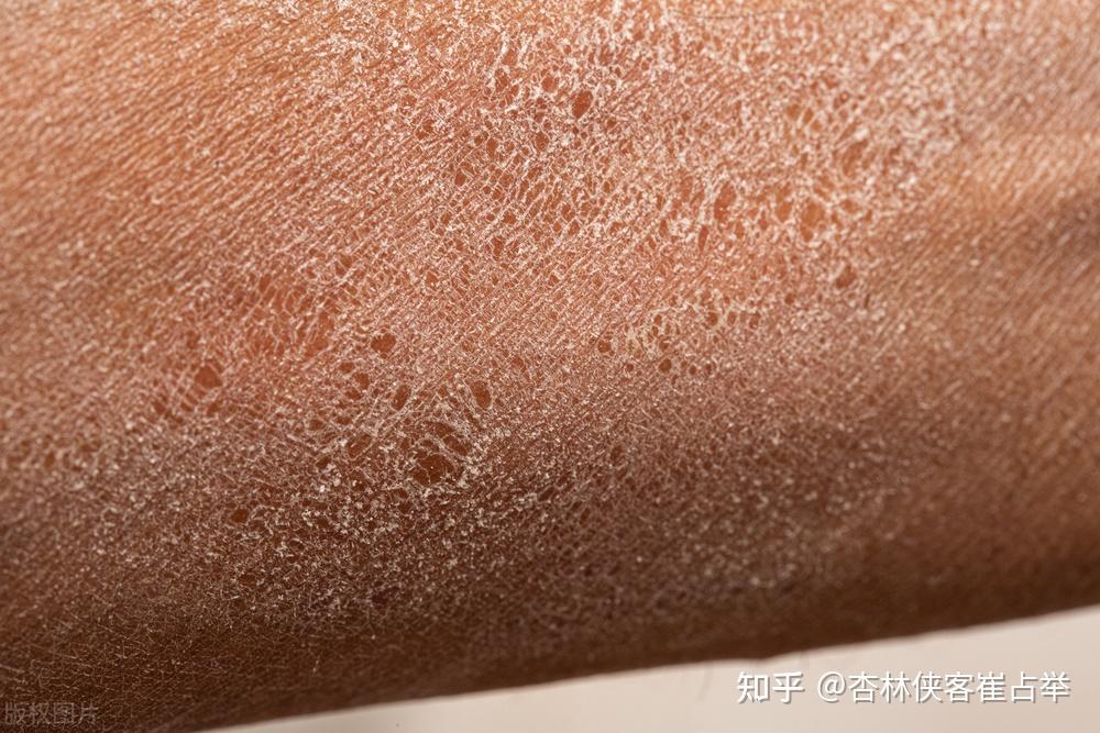 血瘀就会用血府逐瘀丸，那你就错了，搭配一宝，扫清一身瘀血 - 知乎