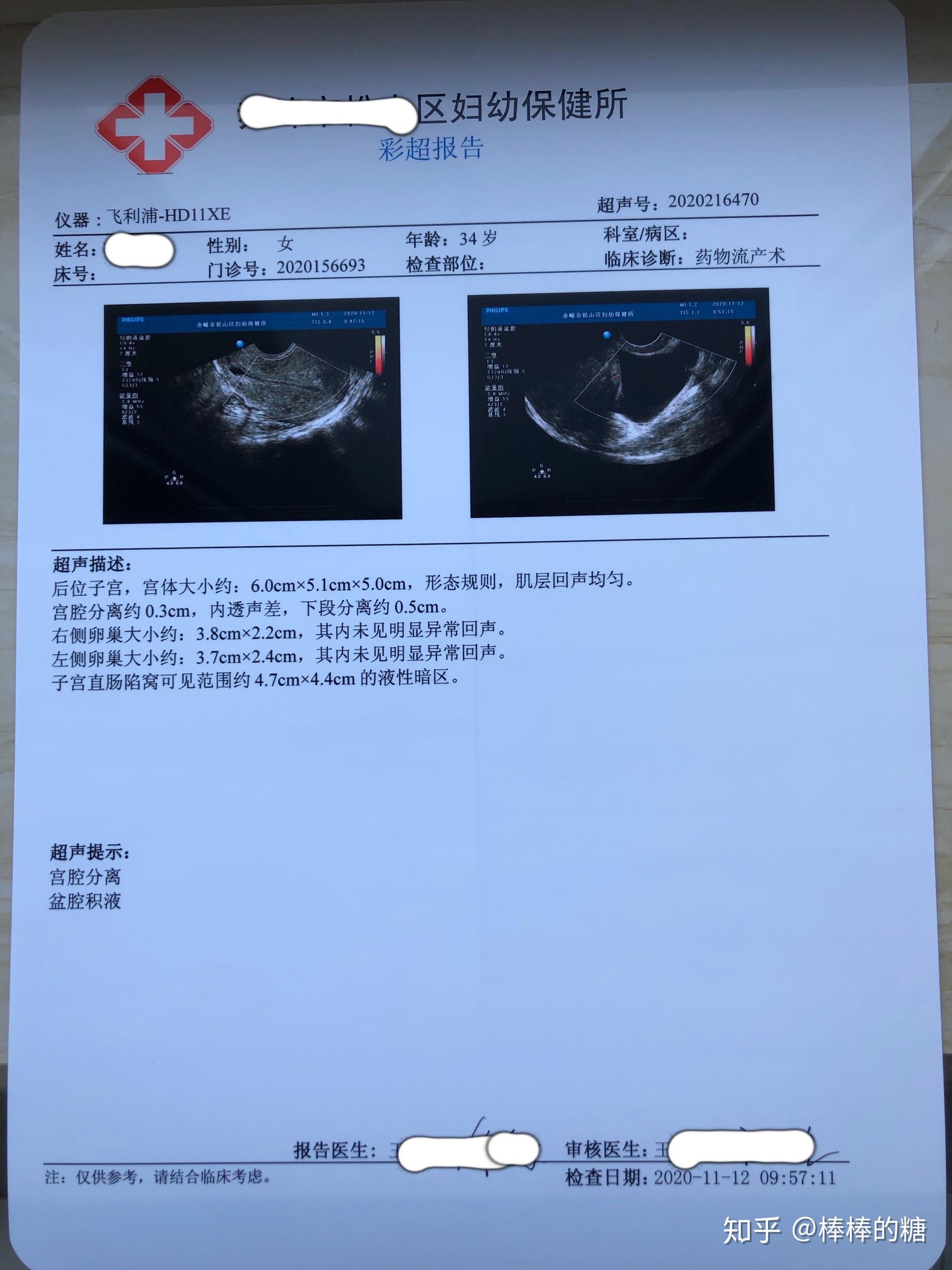 吃完米索胎囊下來是第一步,有些剩餘組織排出總是有個過程,認真吃逐瘀