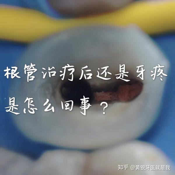 根管治療後還是牙疼是怎麼回事