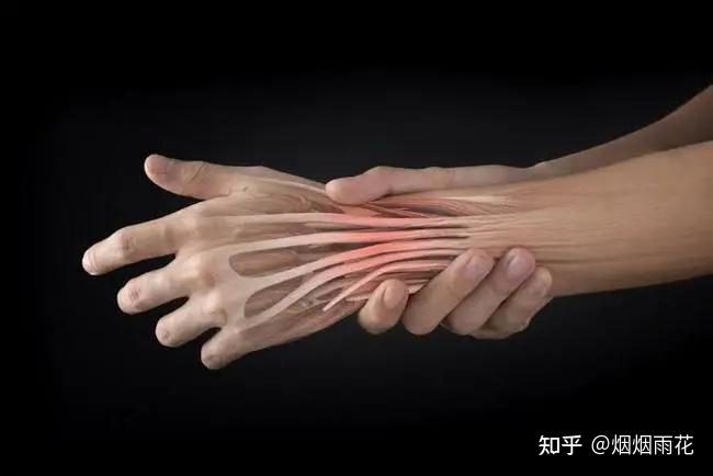 腱炎 zhuanlan.zhihu.com