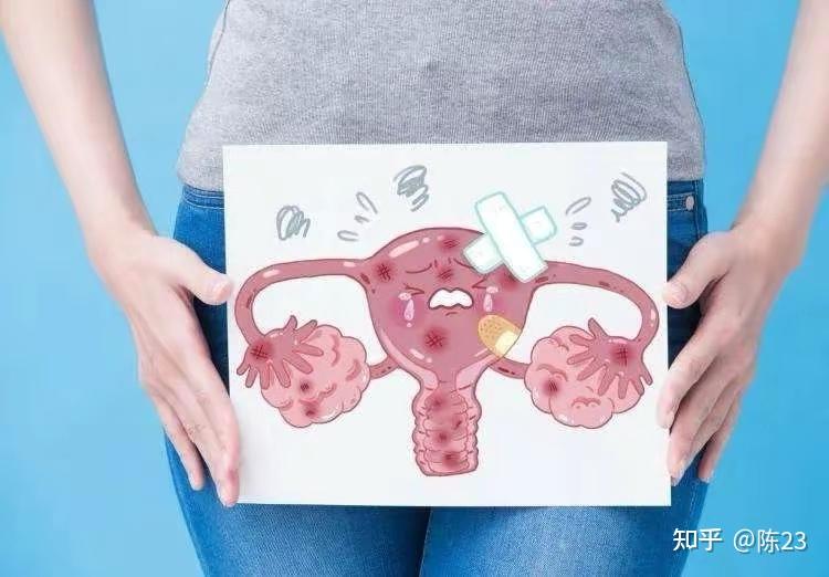 宫颈纳囊要治疗吗?