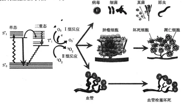 1,光动力治疗原理2,ala光动力治疗3,hmme光动力治疗光动力的作用机制