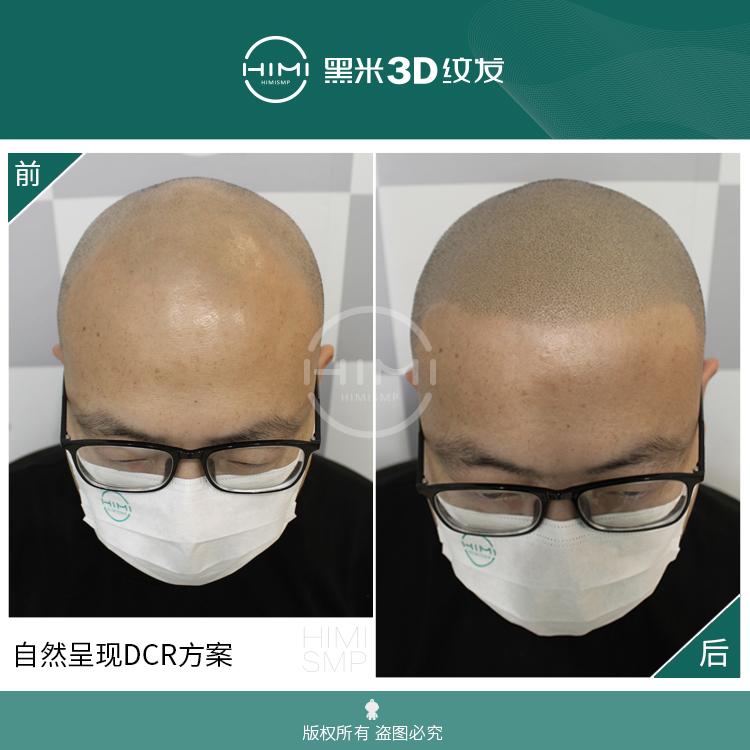 纹发知识科普：3d纹发有哪些应用？ - 知乎
