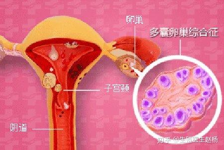 减肥方法有几种方法_减肥方法有哪些_减肥方法有什么