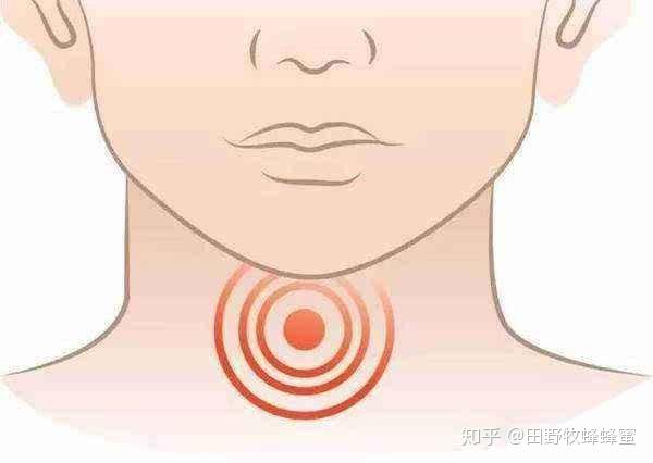 蜂蜜对喉咙有好处吗 蜂蜜喉咙痛可以喝吗 知乎 蜂蜜对喉咙有好处吗 蜂蜜喉咙痛可以喝吗 知乎