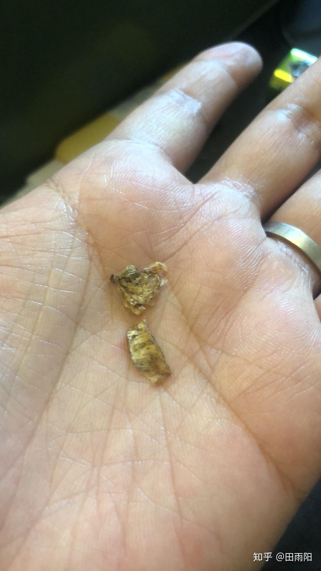 经常掏耳屎的人耳朵里还会有那种超大的耳屎就像一些视频里拍的那样吗