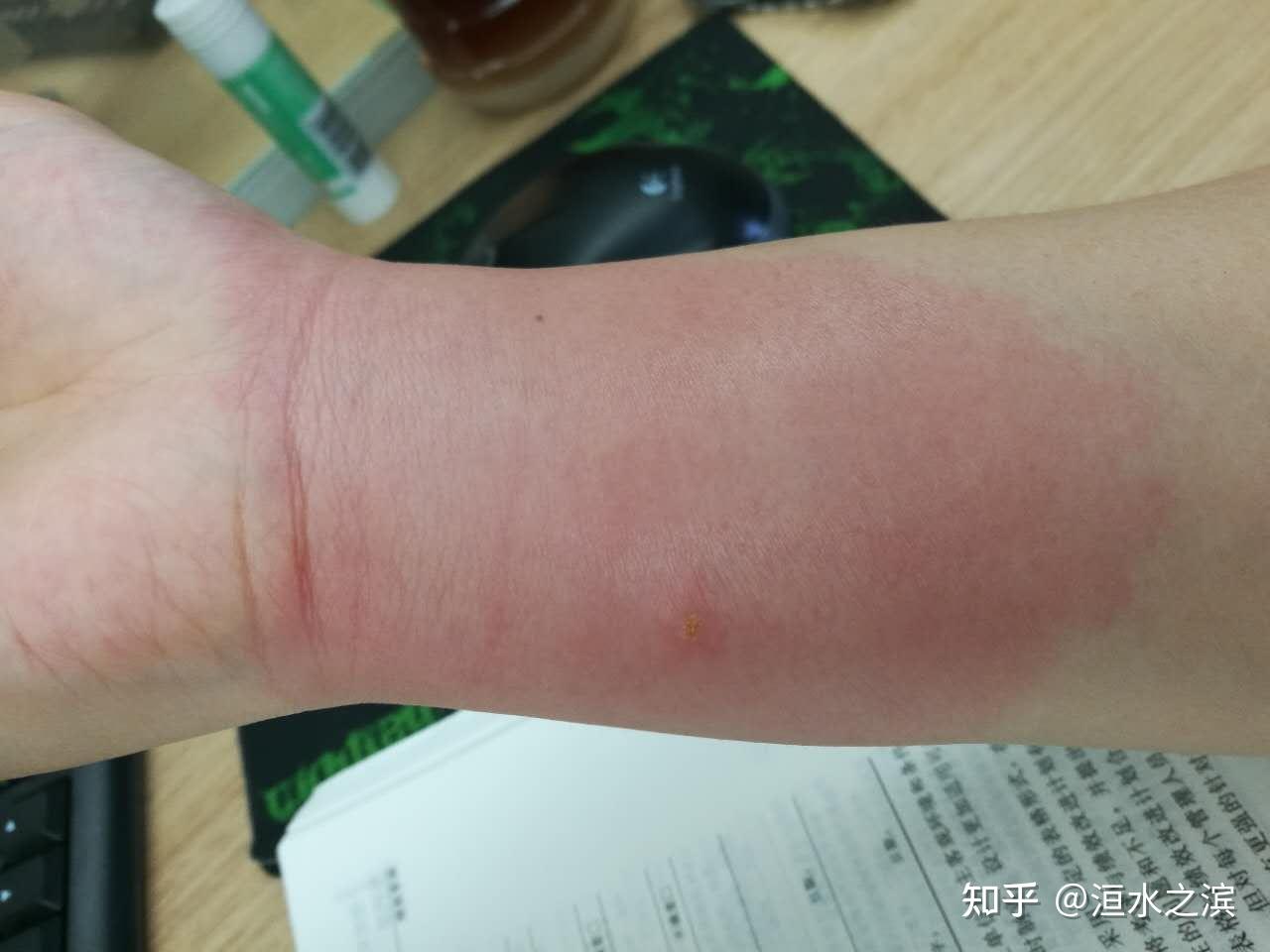 蚁群分工明确,凶狠好斗,群体作战时能联手捕杀昆虫,蚯蚓,青蛙,鸟类