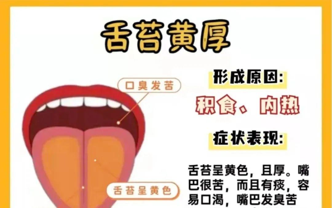 阳虚舌、阴虚舌、肝郁舌、积食舌、寒湿舌、脾阴虚舌..... - 知乎