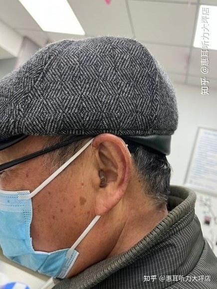 适配各种听力的ric瑞克助听器