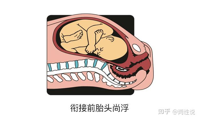 宝宝是怎么从那么窄的产道里出生的?图文揭秘分娩全过程 - 知乎