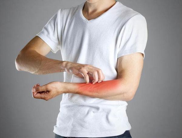 皮肤瘙痒、长湿疹、水泡,二妙丸没用?张仲景用八味药帮你解决 - 知乎