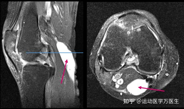 2 Things You Must Know About Wildrobincasino