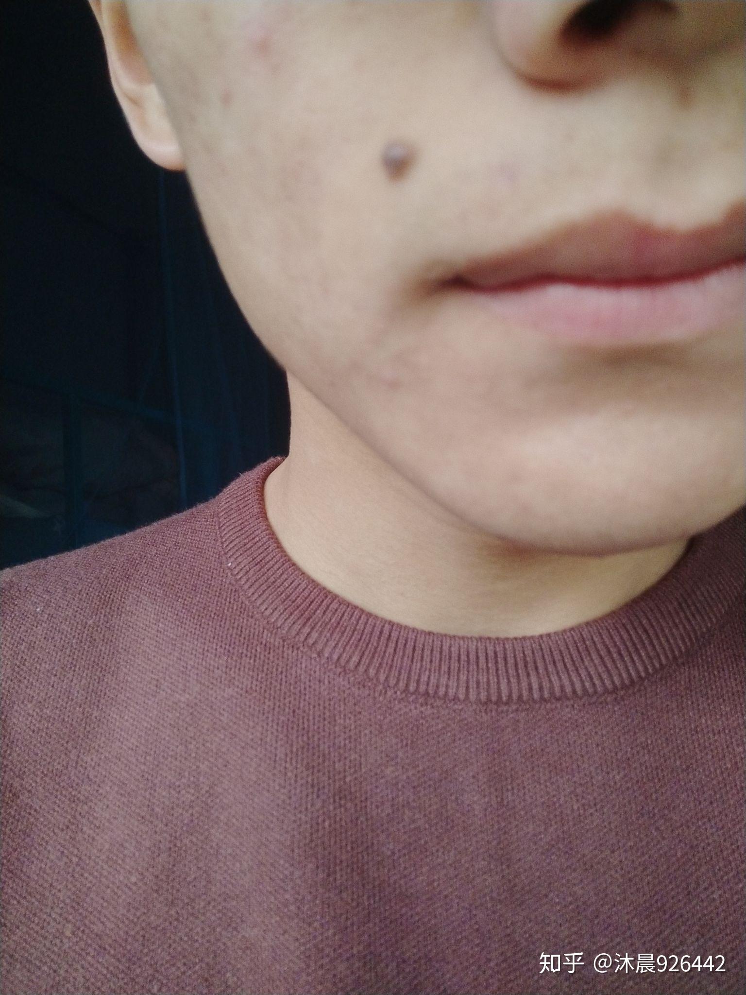 舍友会说我长了一个媒婆痣,我有时候也很想去跟女生轻松的交流,想帅气