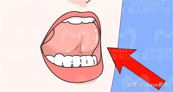 涨知识！舌头放错位置竟影响牙齿和颜值？快看看你的舌头放对了吗？ - 知乎