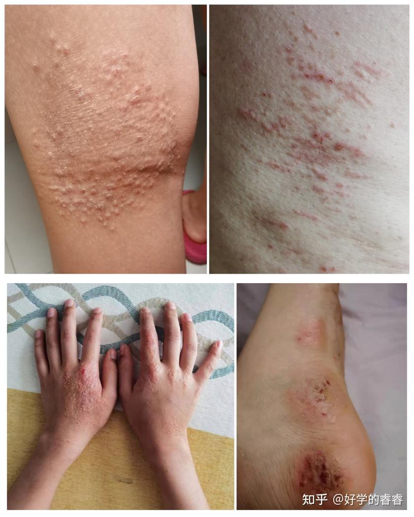 纽达睿ad战胜特皮的幕后黑手