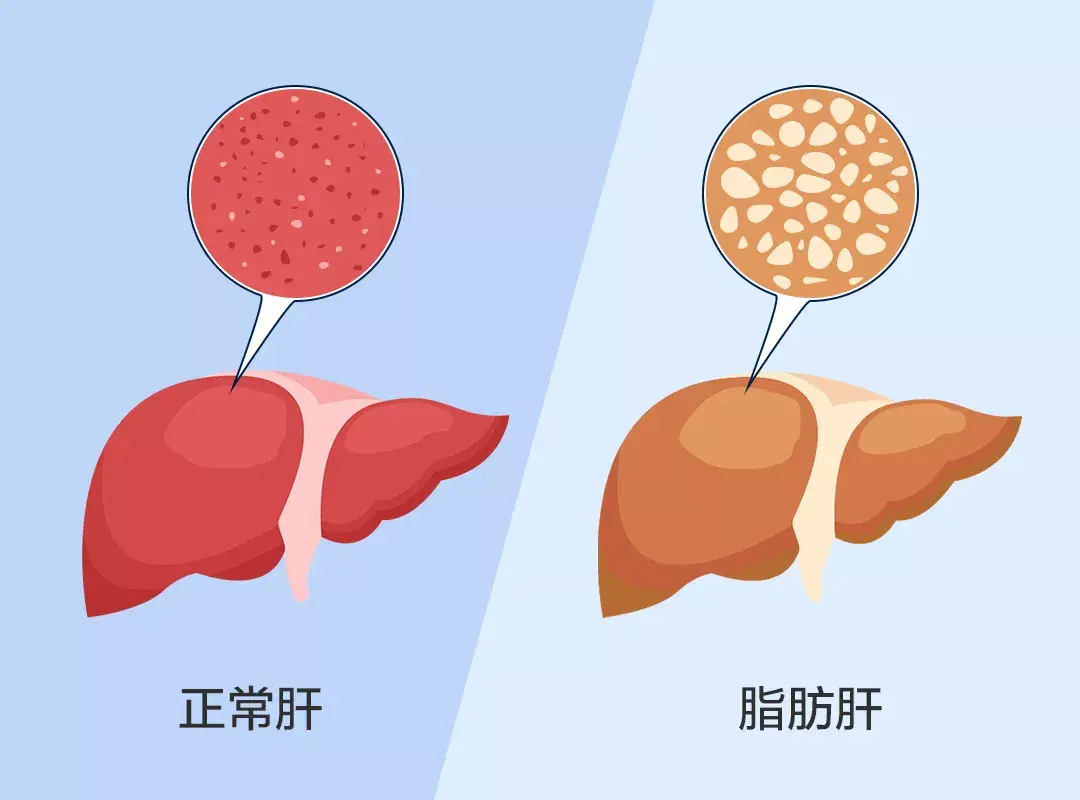 食物最养肝护肝_养肝护肝吃什么食物好_食物养肝吃些什么