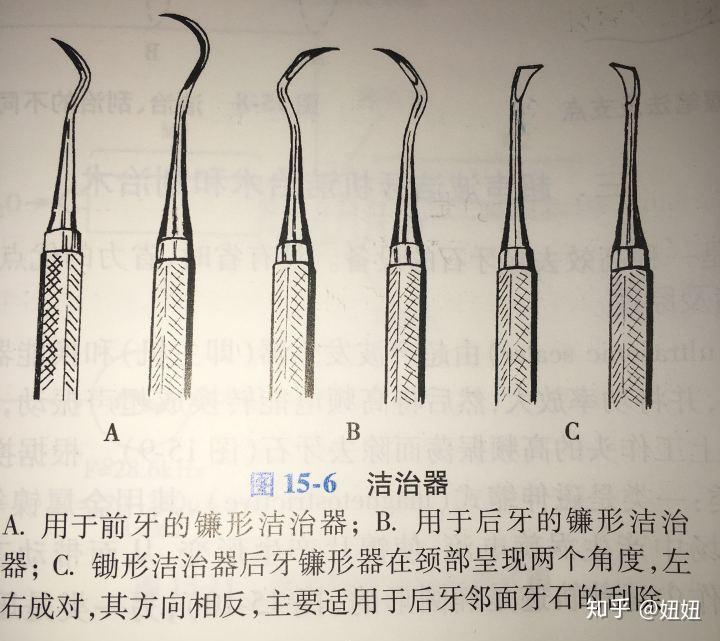 同样是清理牙结石治疗牙周炎,龈上洁治(洗牙)和龈下刮治的费用差别