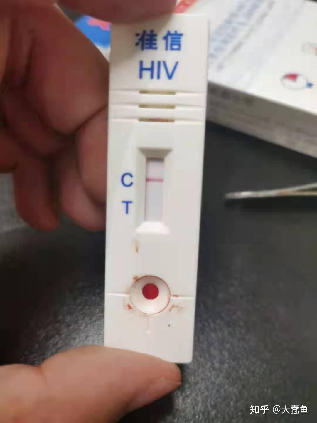 hiv试纸显示阴性一定是正常的吗?