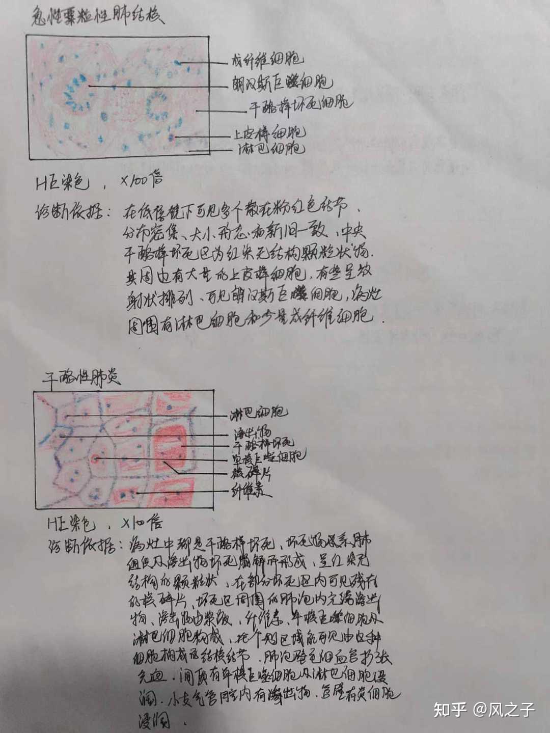 绘制粟粒性肺结核,干酪性肺炎病理切片图,标明病变,说明诊断依据