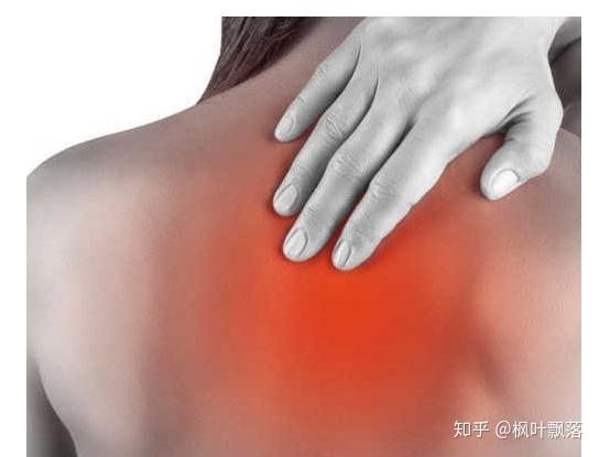 颈肩肌筋膜炎的症状图
