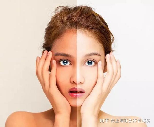 【旺昌健康】皮肤容易晒黑的人,有一个天生的优势… - 知乎