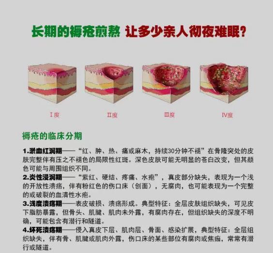 真实褥疮恢复经历!别等溃烂成洞才治疗,早期预防是关键!