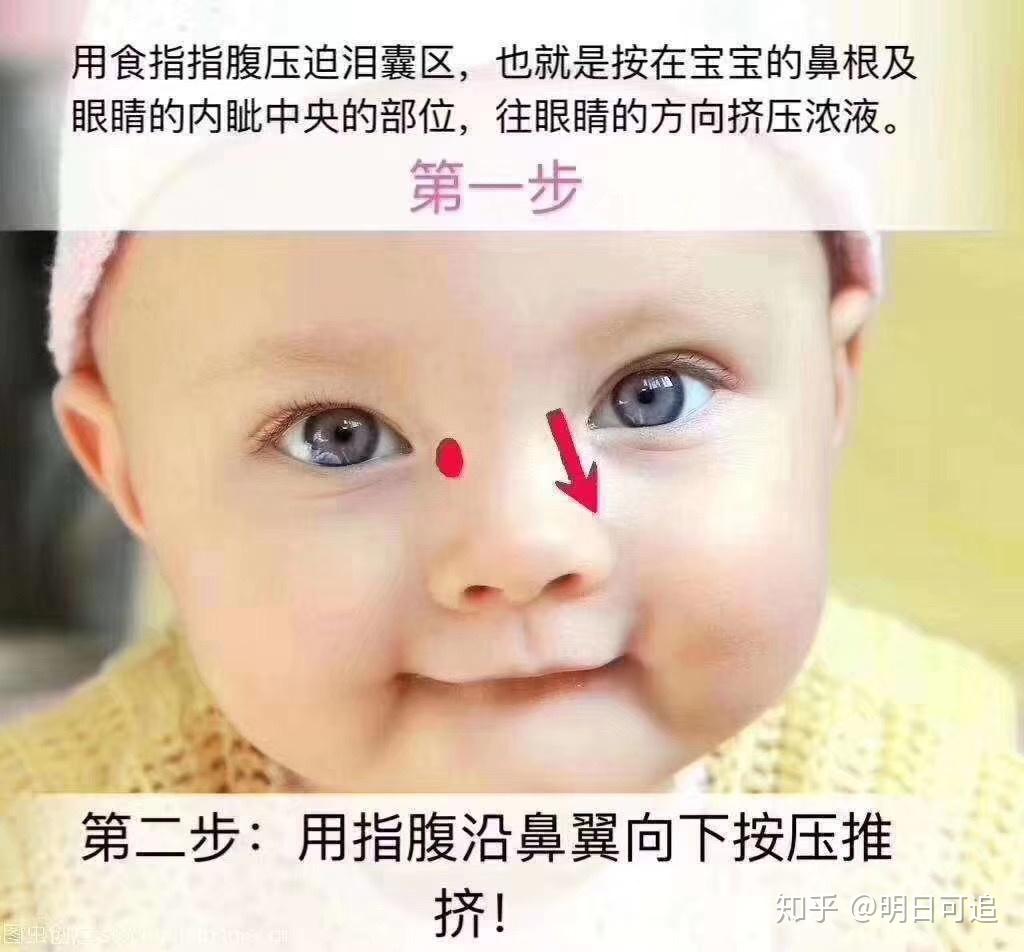 新生儿鼻子不通气，怎么处理 知乎