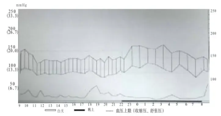 如何正确服用降压药物?一文看懂 - 知乎