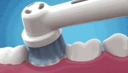 怎么样才算有效刷牙 v2-1c738b13b8bc2c4090bb153ac5a52ae2_r.jpg